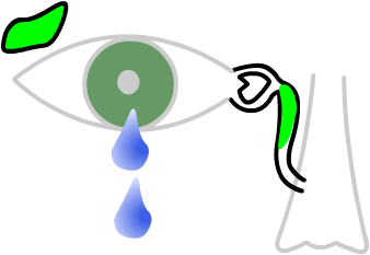 a blocked tear sac causes a watery eye