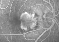 wet armd shown with an angiogram