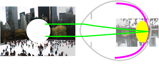 scotoma with macular degeneration