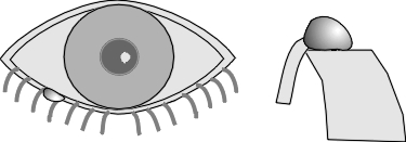 cyst of moll
