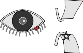 diagram of stye