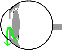 aqueous fluid draining out of the eye