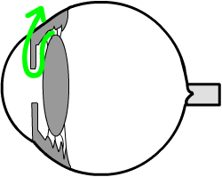 aqueous draining through the anterior chamber, and draining through the trabecular meshwork and canal of schlemm