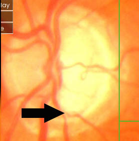 the arrow points to the notch
