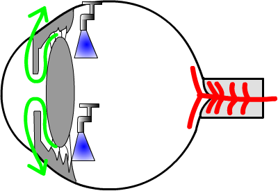 aqueous fluid produced in the eye drains out; blood flows into the optic nerve