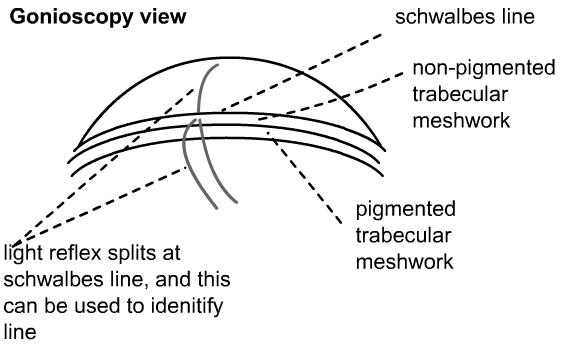 goniocopy view...double slit shows schwalbe's line