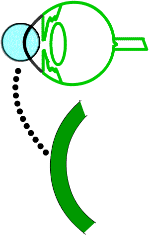 close up view of cornea, diagram