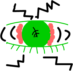 dendritic ulcer is painful: diagram
