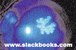 a dendritic ulcer with many 'dendrites'