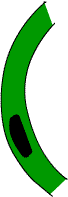 diagram of stromal keratitis
