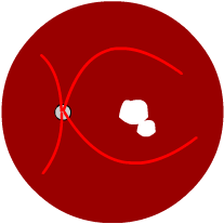 geographic macular degeneration, diagram