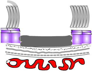 macular scar diagram ARMD