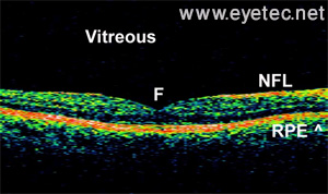 healthy macula  OCT