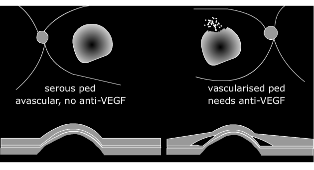 serous and vascularised peds