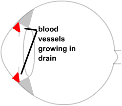diagram of rubeotic vessels