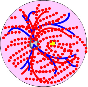 central retinal vein occlusion