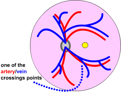 front view of eye showing artery/vein crossing point