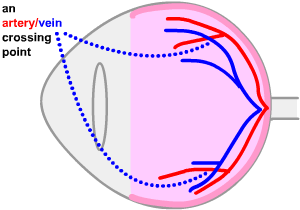 side view of eye showing artery/vein crossing point
