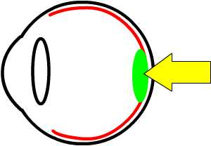 macular oedema / ARMD